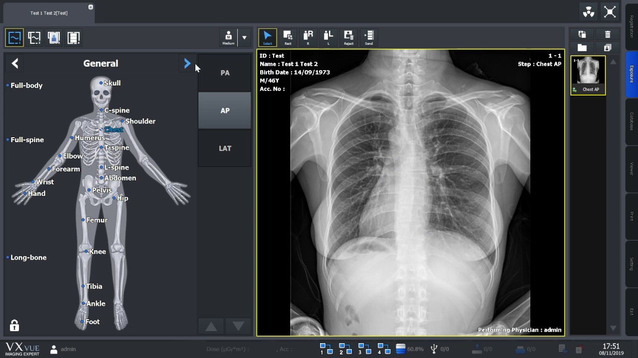 Human - Demo VxVue