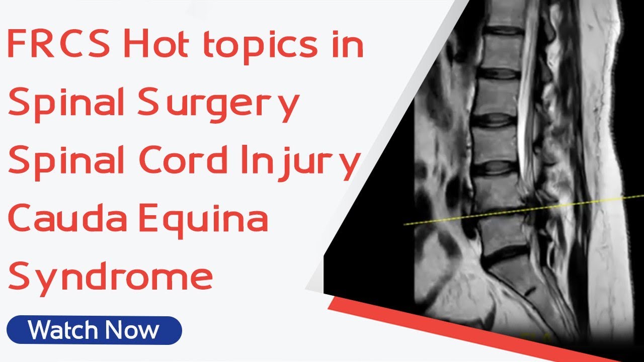 FRCS Hot topics in Spinal Surgery - Spinal Cord Injury | Cauda Equina Syndrome | Academy