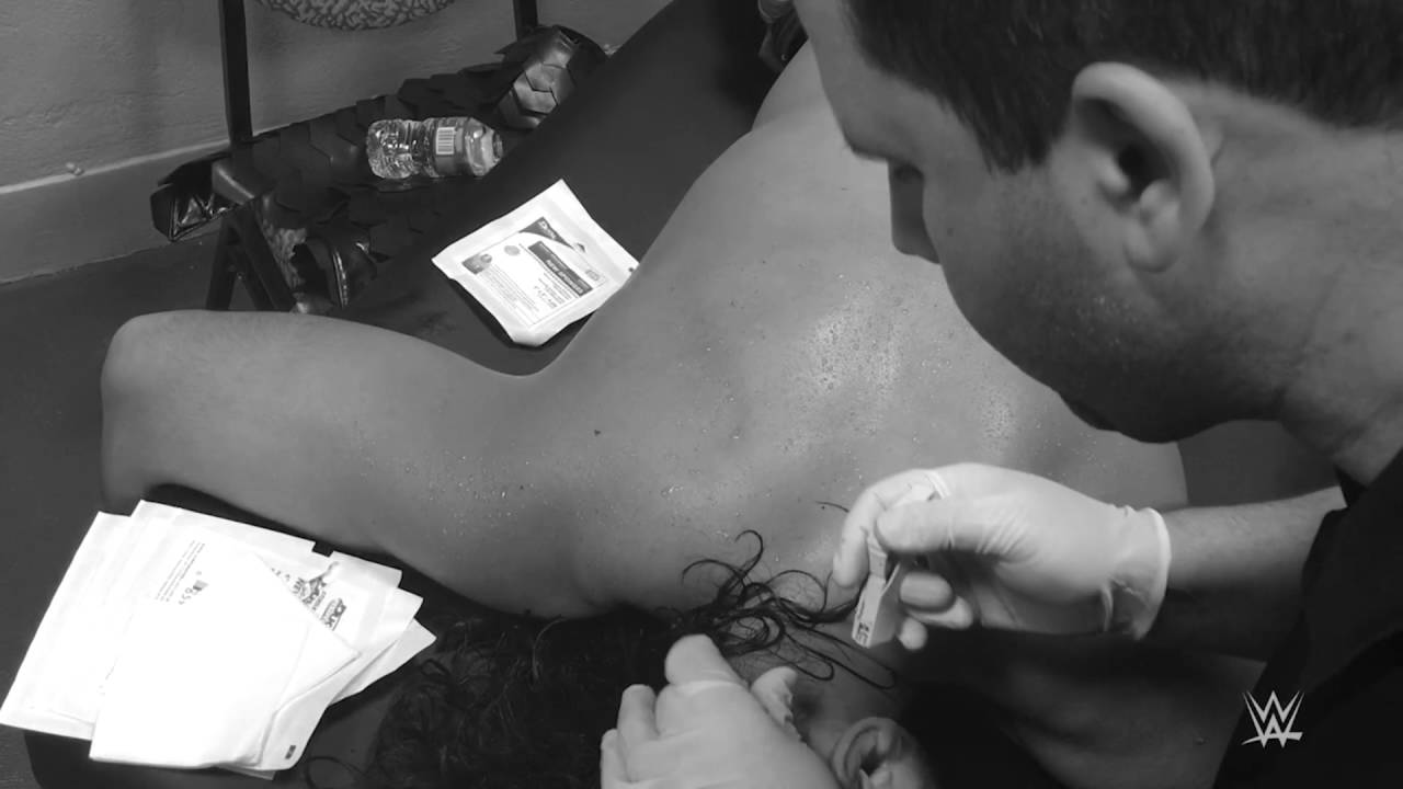 Shinsuke Nakamura receives staples