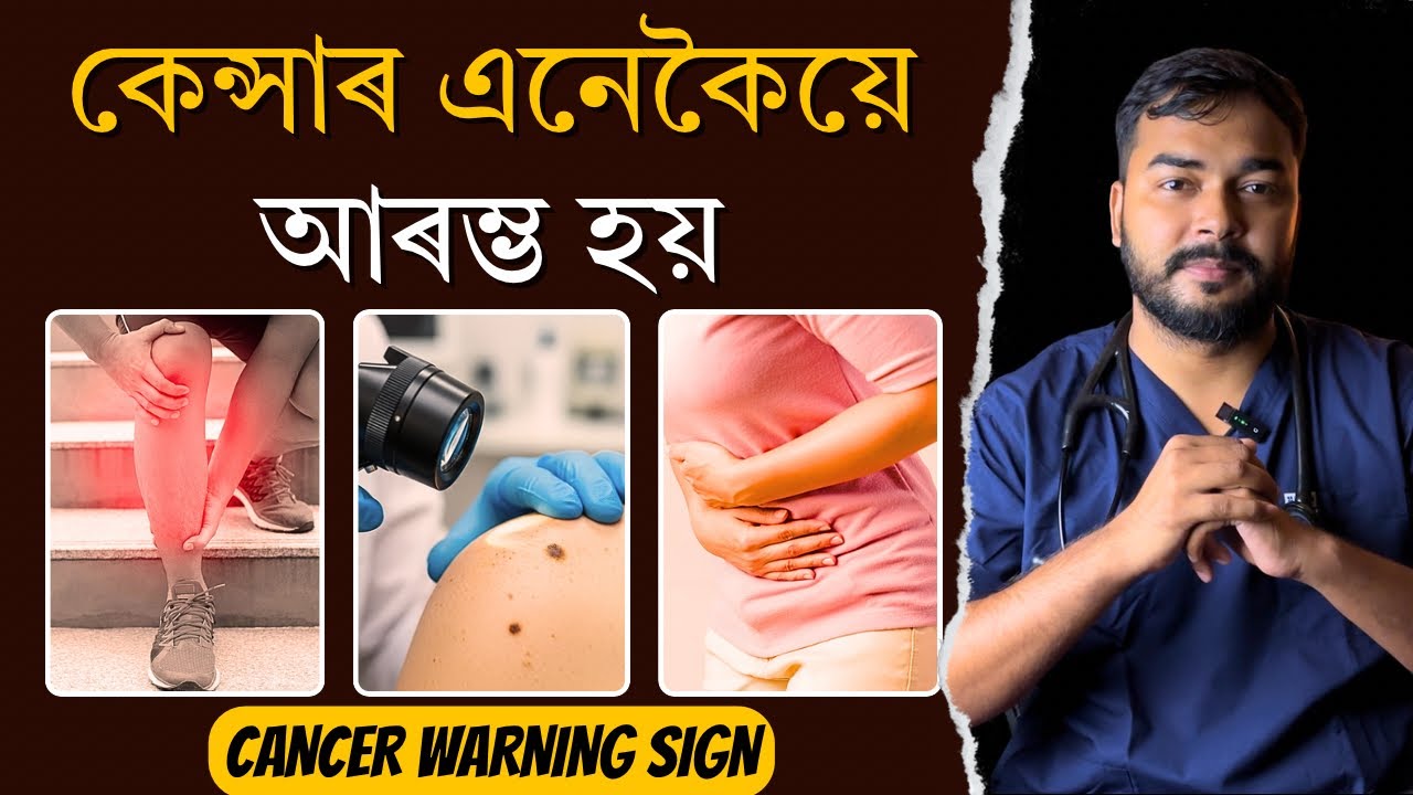 কেন্সাৰৰ ৯টা আগতীয়া লক্ষণ আৰু সংকেত | 9 Early Warning signs of Cancer | Dr. Hriday J Deka