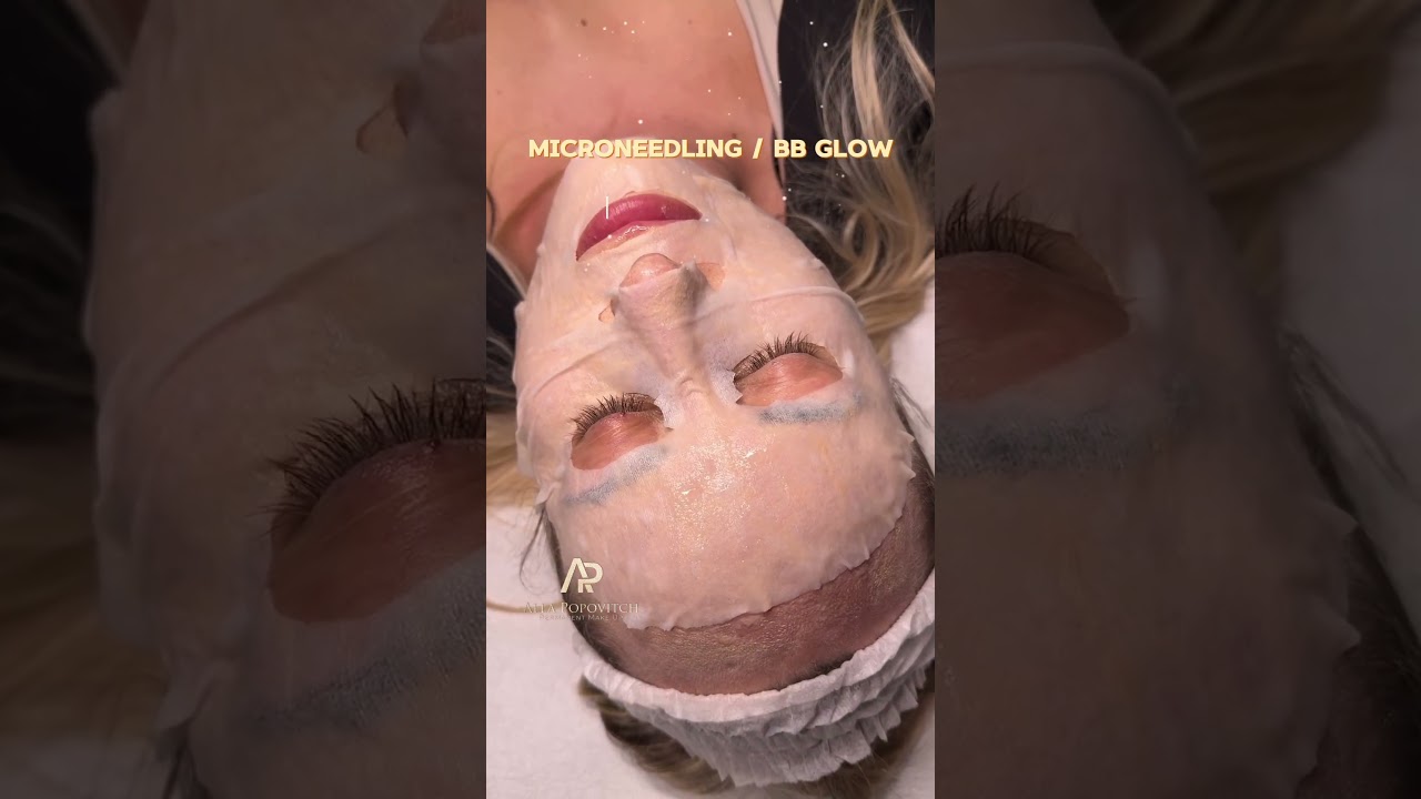 Pelle perfetta Microneedling Bbglow #microneedling #bbglow #pelleperfetta #trieste #corsi