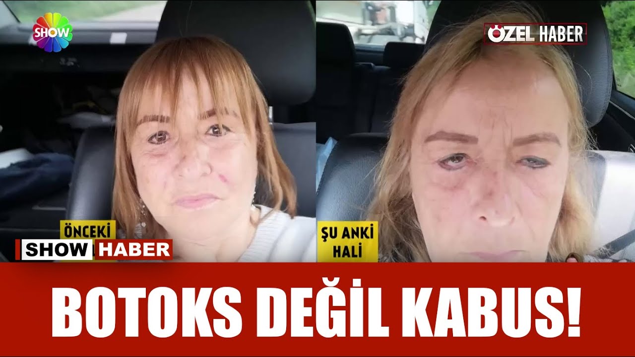 Güzelleşmek isterken, perişan oldu