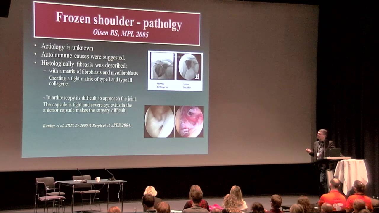How to handle rotator cuff - Sports Medicine Congress 2016