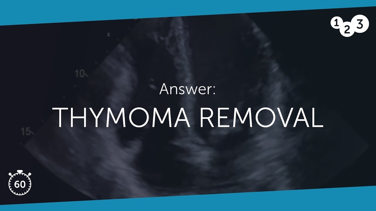 60 Seconds of Echo Teaching Answer: Thymoma Removal