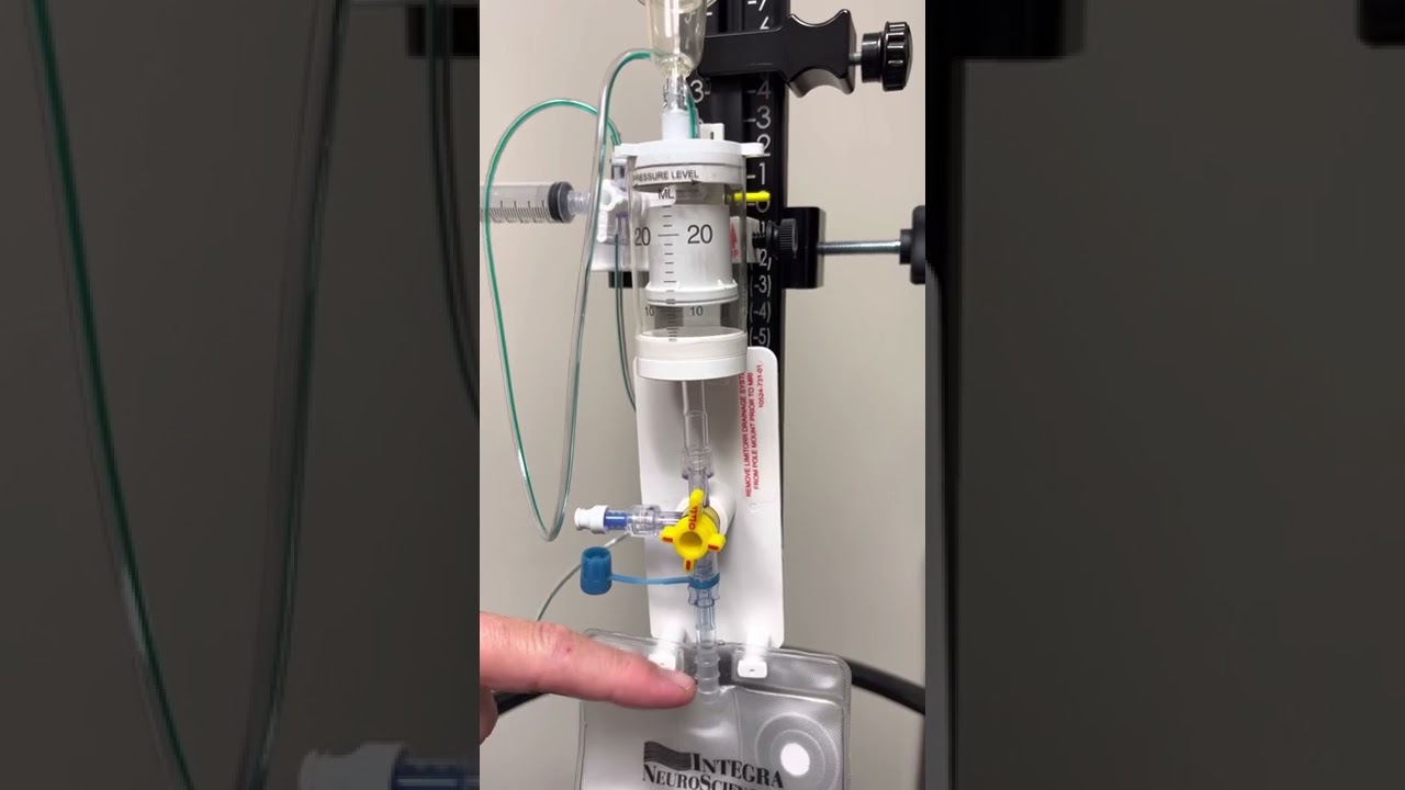 Lumbar Drain
