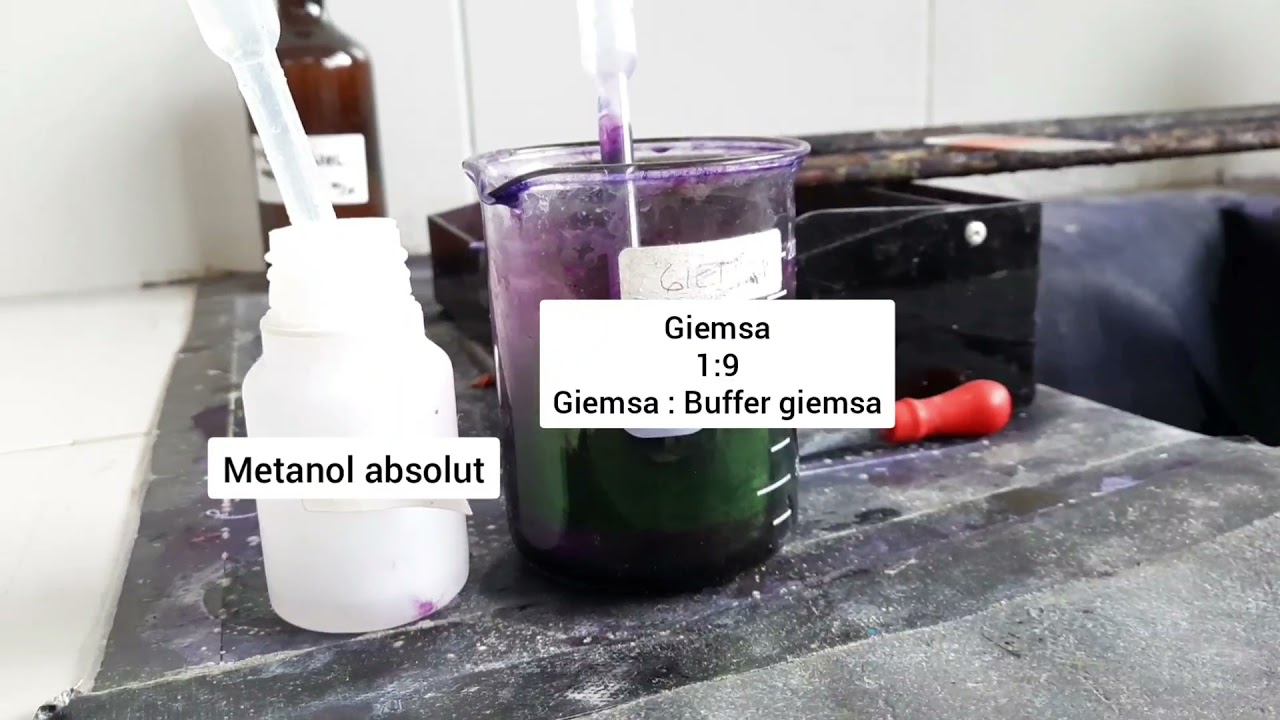 PEMBUATAN SEDIAAN APUS DARAH TEPI