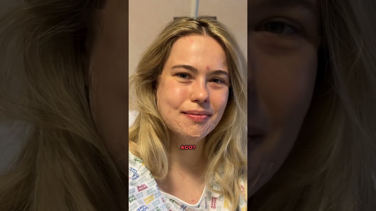Don&rsquo;t do double jaw surgery
