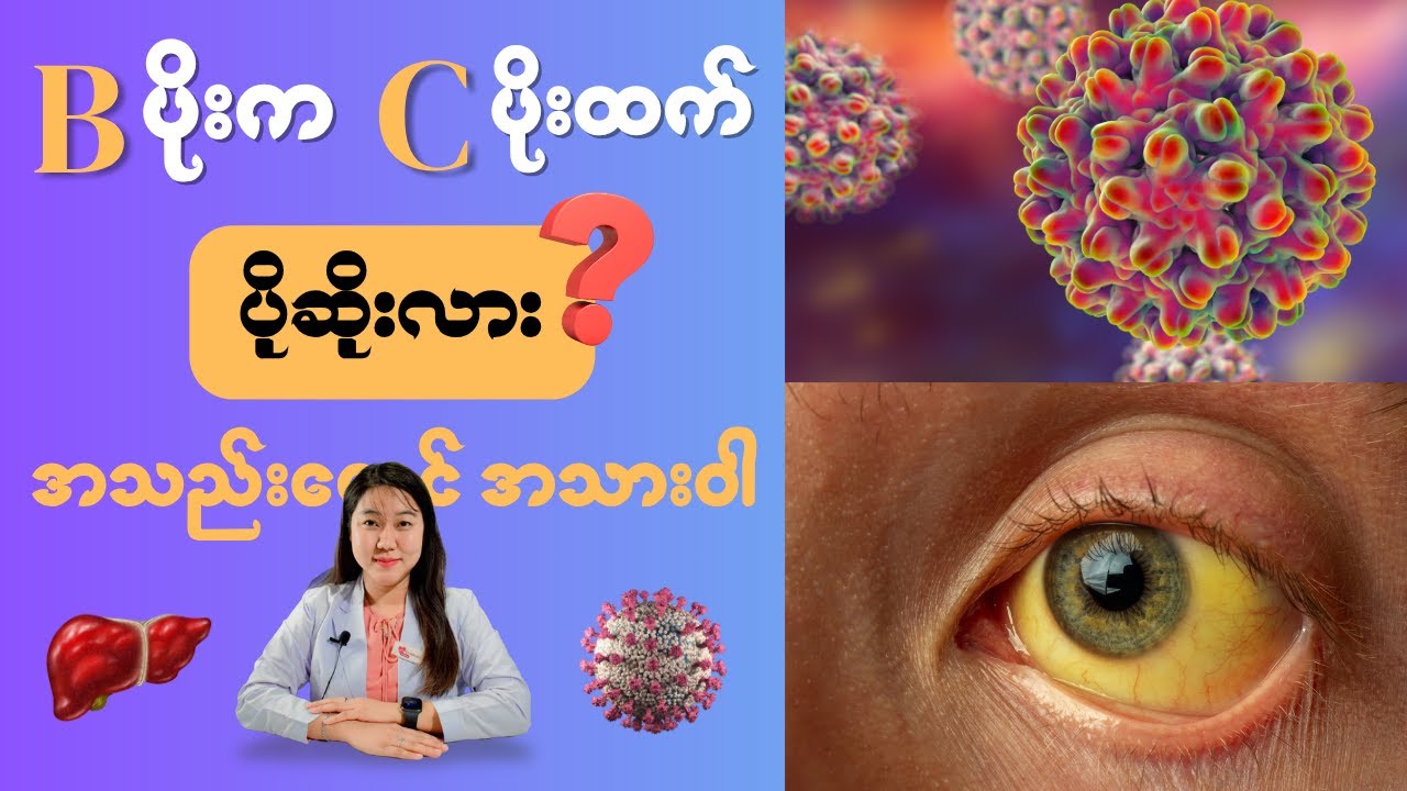 ဘီပိုးက စီပိုးထက် ပိုဆိုးလား? B ပိုး C ပိုး အကြောင်း