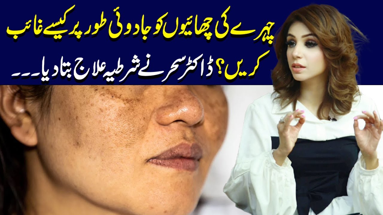 No More Freckles! Try This Magical Treatment | Dr Sahar Chawla