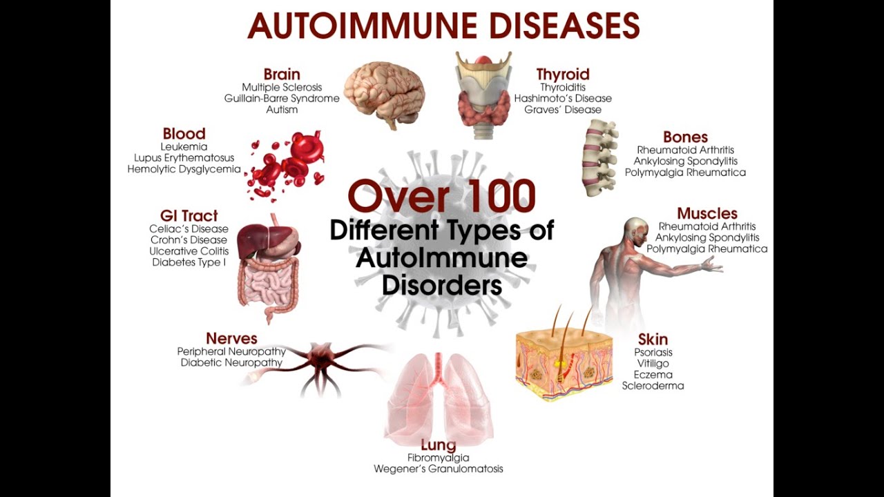 Predictive AutoAntibodies- Testing For Autoimmune disease