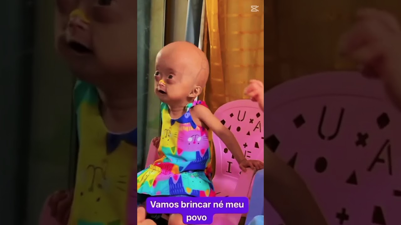 Elis e Eloa ❤❤❤ #progeria  #irmagemeas #eliseeloa