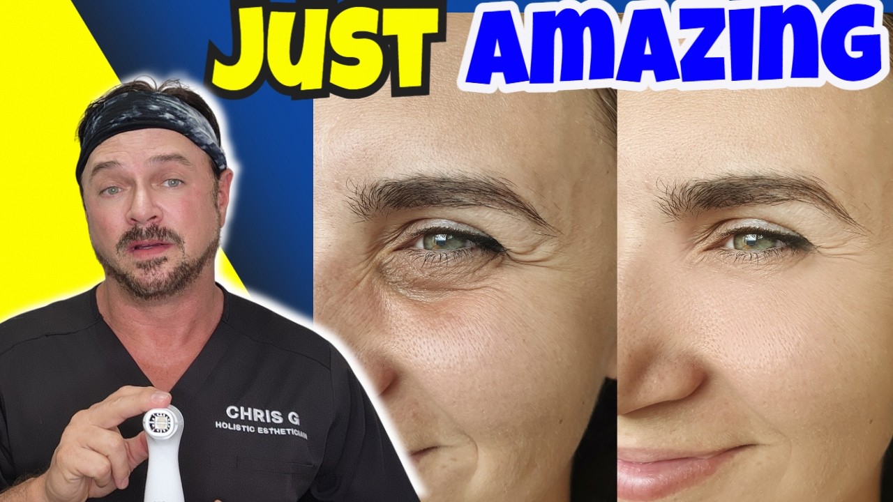 Forget Injections | This NEW Laser Does It Better!