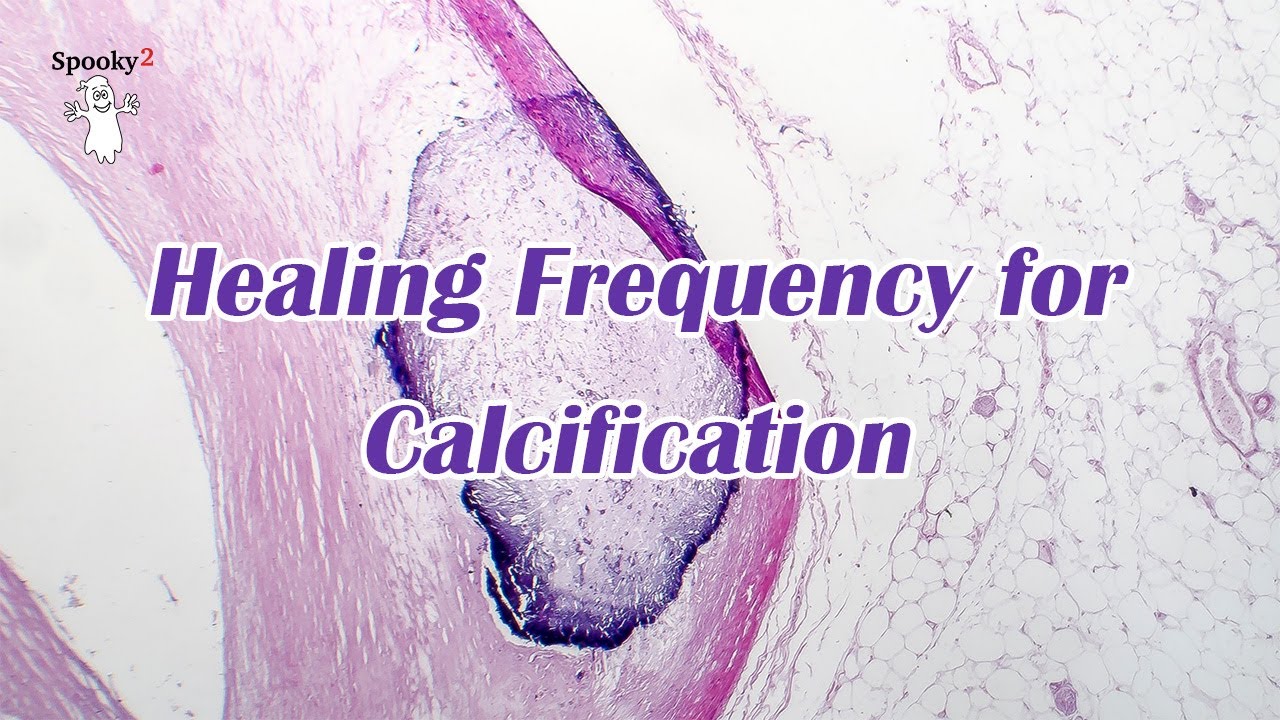 Healing Frequency for Calcification - Spooky2 Rife Frequencies