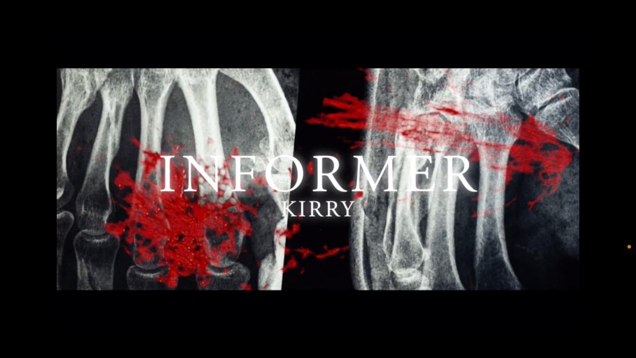 KIRRY - INFORMER(PV)