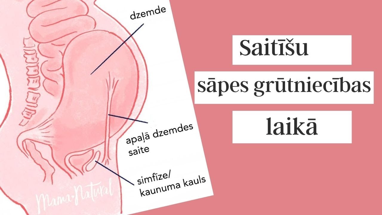 Saitīšu sāpes grūtniecības laikā