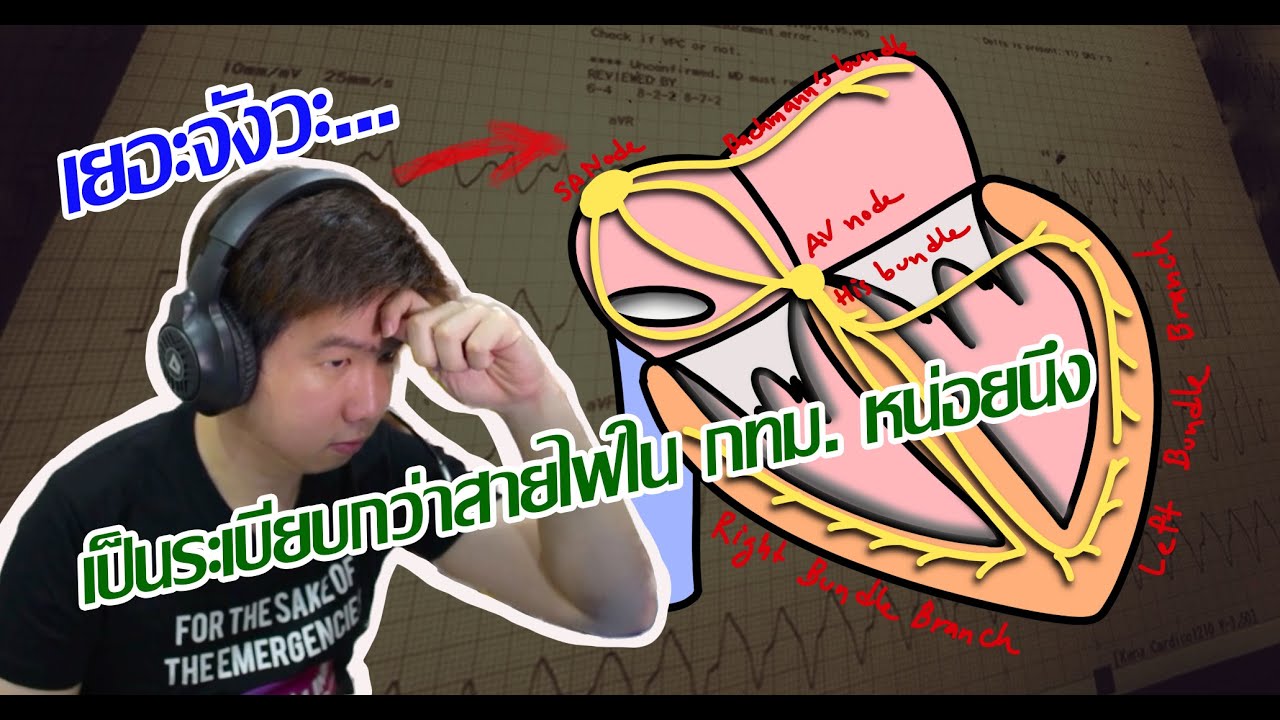 รวบยอดพื้นฐาน การนำไฟฟ้าในหัวใจ[AV Block Part 1/4] | Frontline EKG