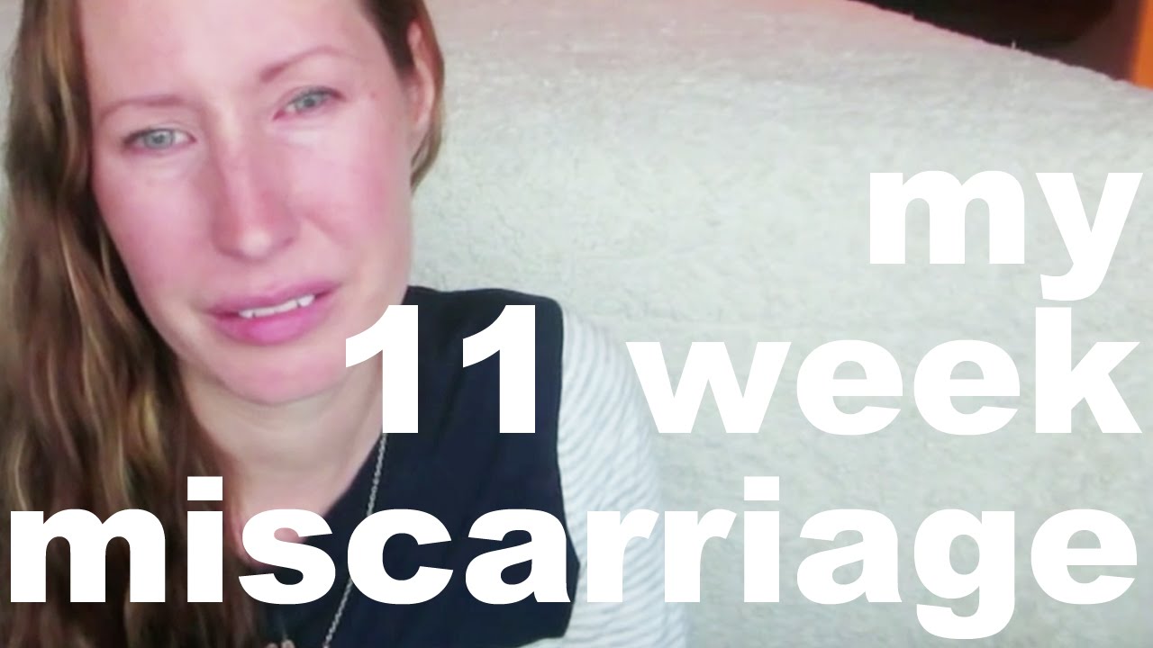 11 WEEK MISSED MISCARRIAGE | MY STORY