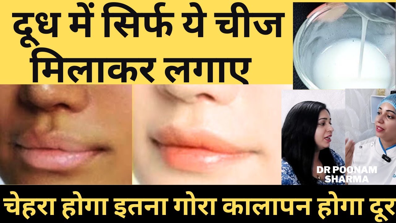 दूध से पाएं गोरी और बेदाग़ स्किन |  How To Get Fair And Glowing Skin At Home |