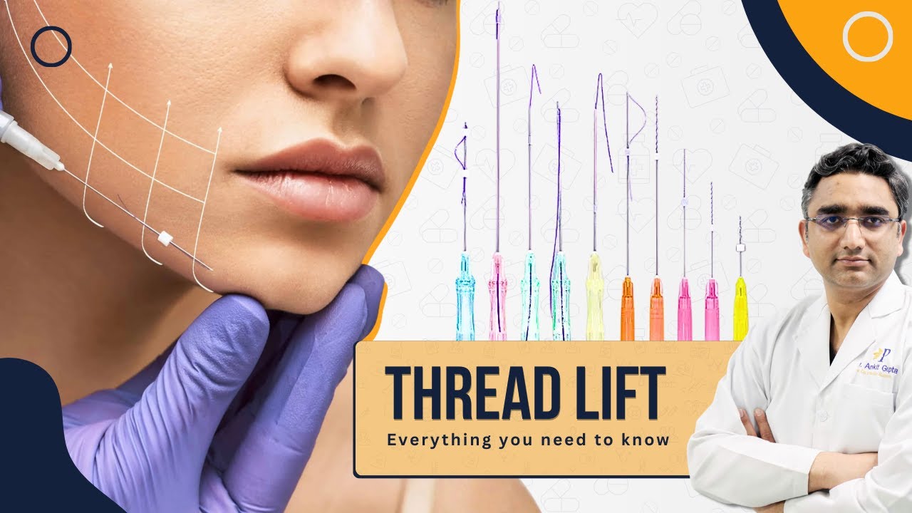 Thread Lift or Non-Surgical Facelift for Mid Face Sagging | Get Rid of Marionette Lines & Jowls