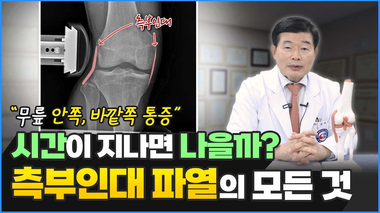 측부인대 파열에 대해 자주 묻는 질문들을 전부 모았습니다.