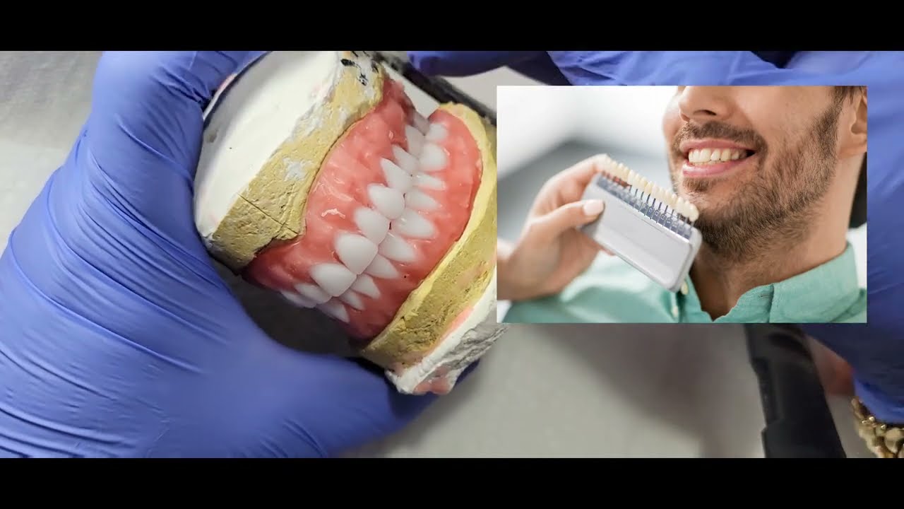 Dentures + Teeth + Shades? You won't BELIEVE What Happened Next!