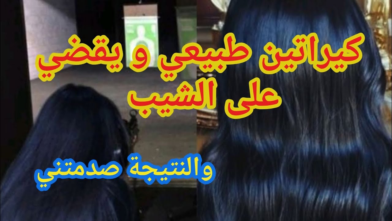 وصفة العفصة في القضاء على الشيب ... هل حقا فعالة