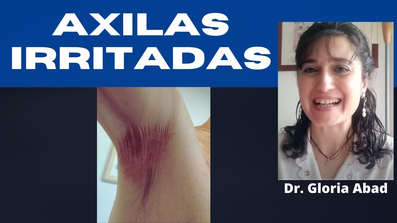 AXILAS IRRITADAS ¿HONGO O DERMATITIS? ¡Me pica DEBAJO DEL BRAZO, CÓMO SOLUCIONARLO!
