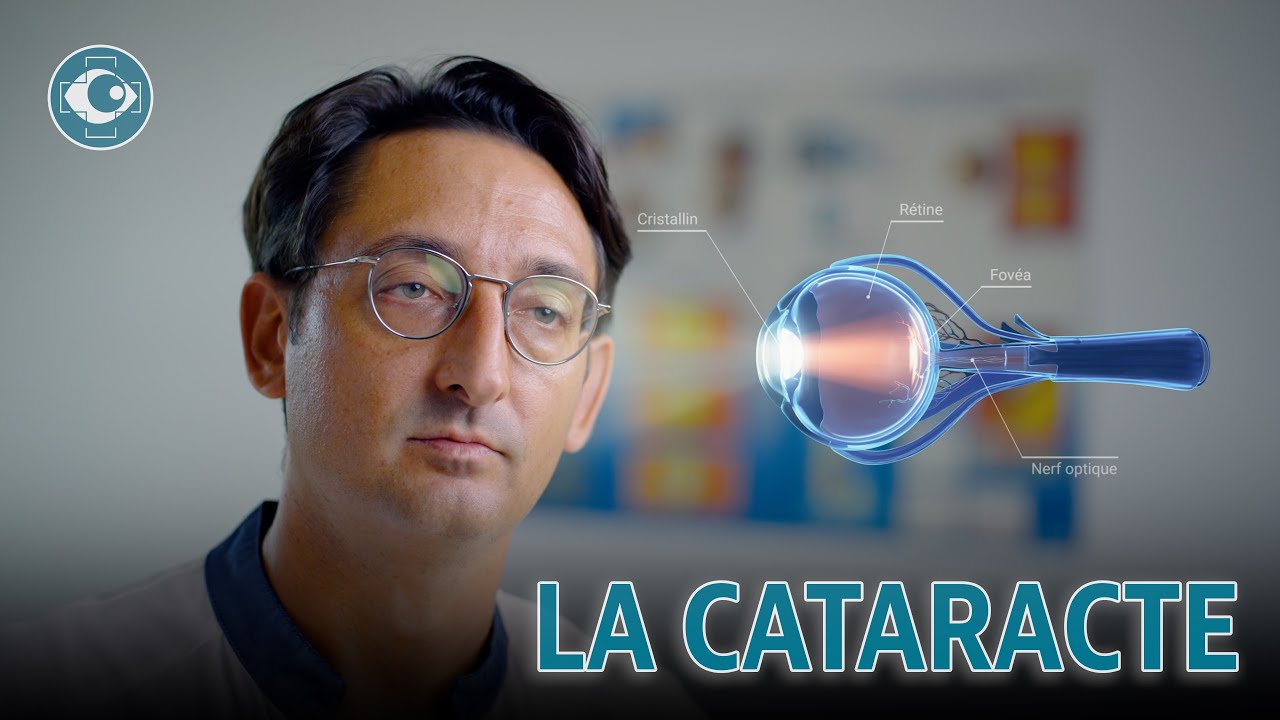 Cataracte : Les étapes de la chirurgie