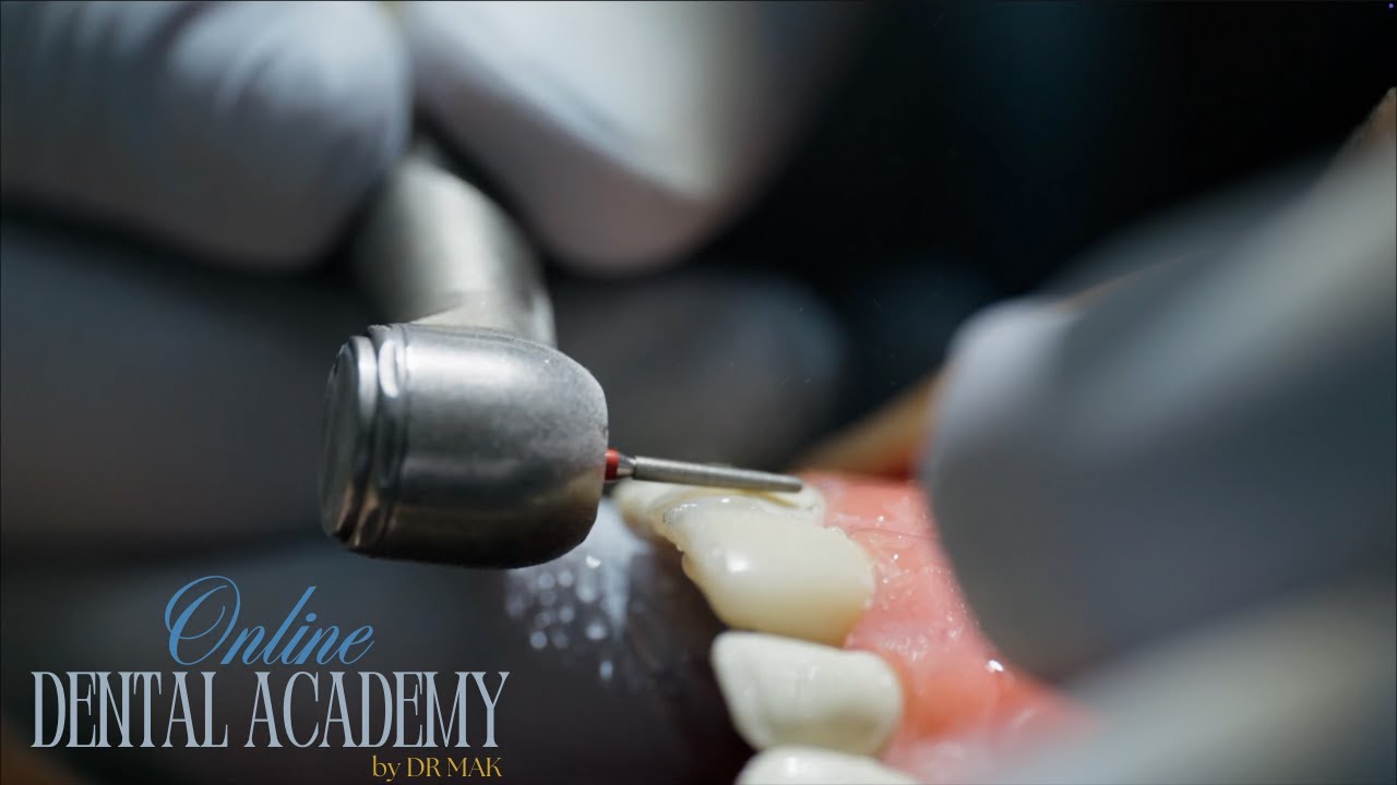 Essential Dental Fundamentals EVERY Student Needs To Know - DR MAK'S DENTAL ACADEMY