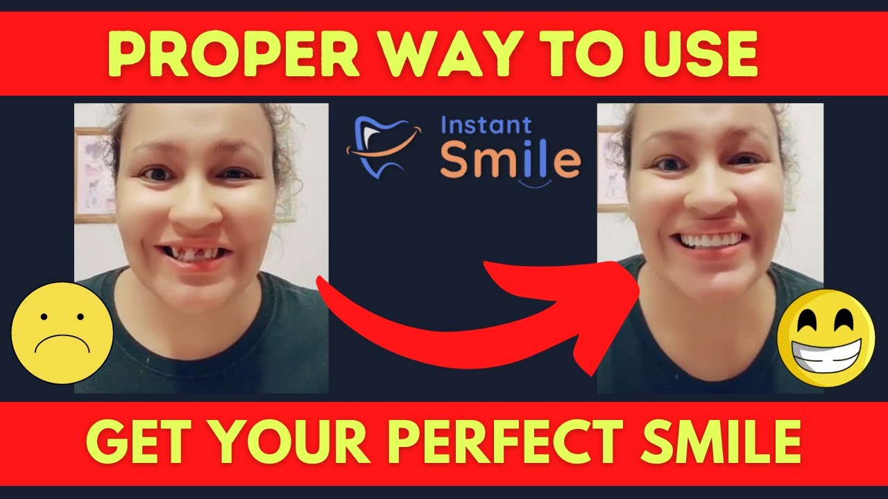Как использовать виниры Instant Smile при отсутствии зубов? (2025)