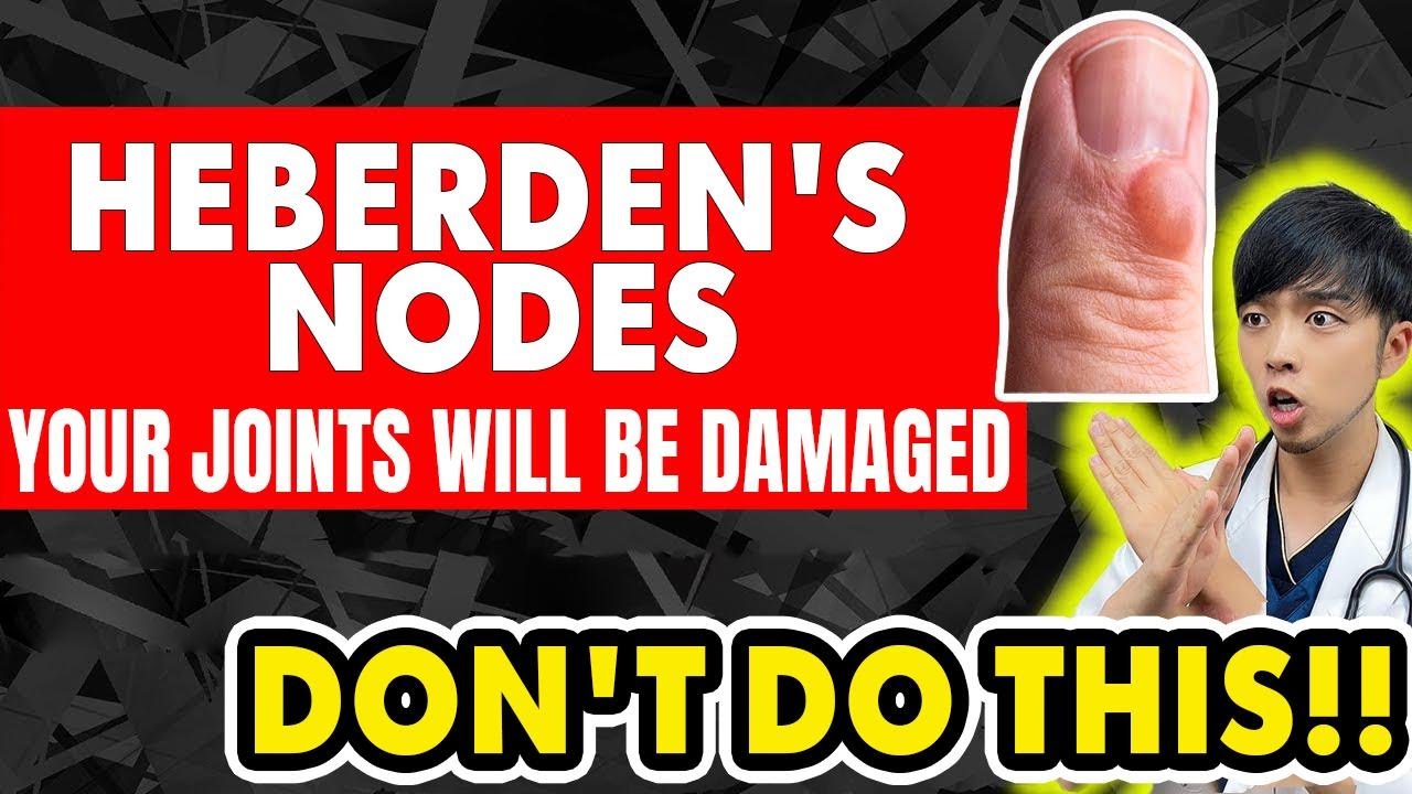 Stop Doing This! Make Heberden's Nodes Worse—Doctor Explains How to Heal & Self-Care Tips