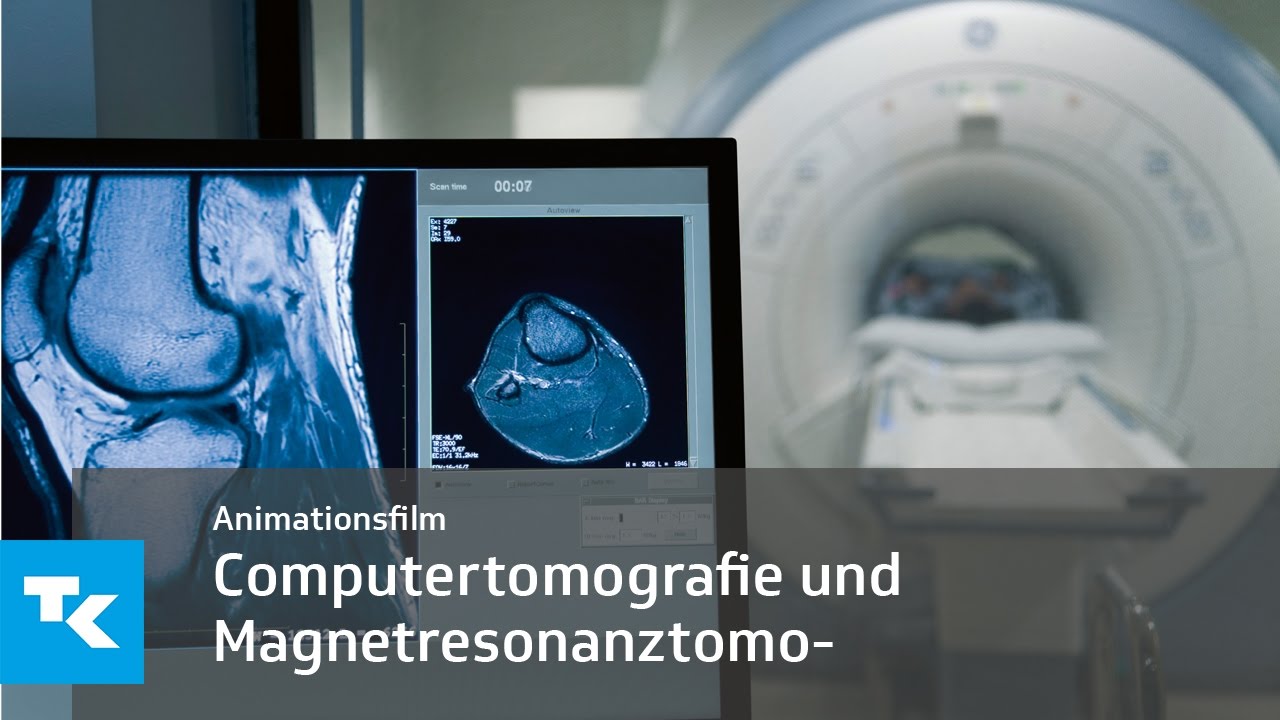 Schicht für Schicht: Animationsfilm zur Computertomografie und Magnetresonanztomografie