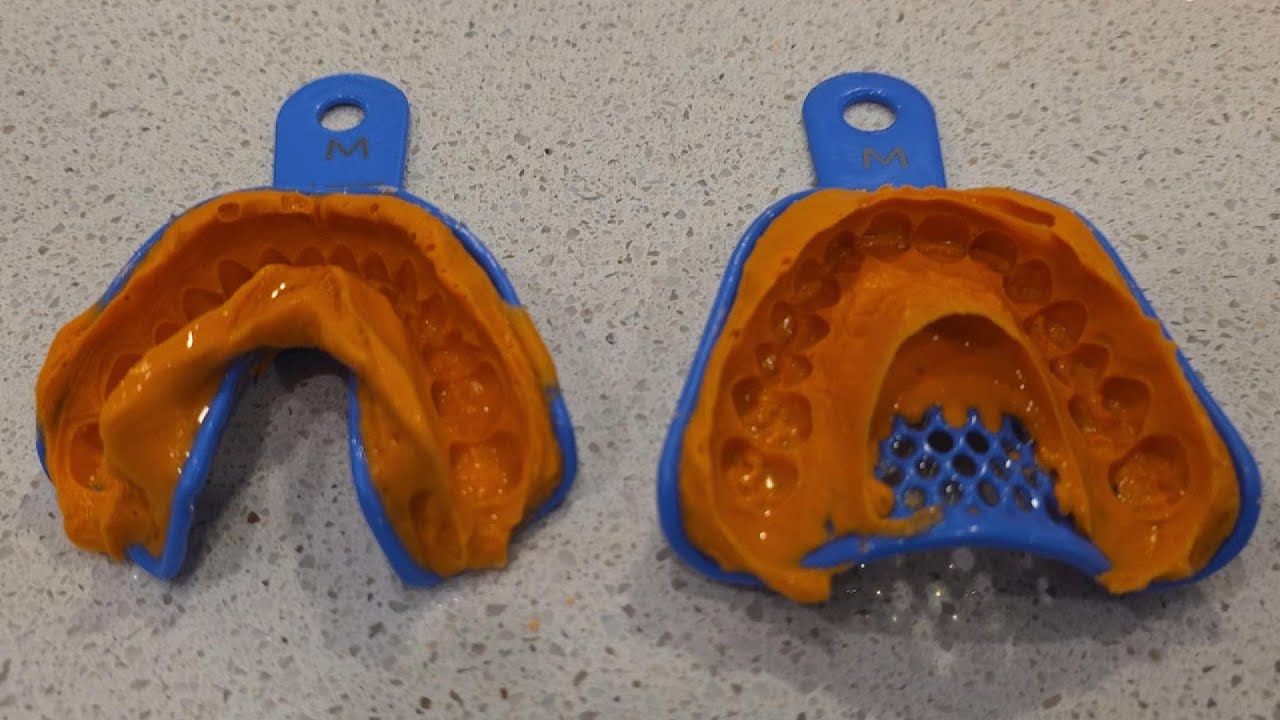 REVIEW - Custom Retainers for Teeth – Upper and Lower Clear Retainer Set