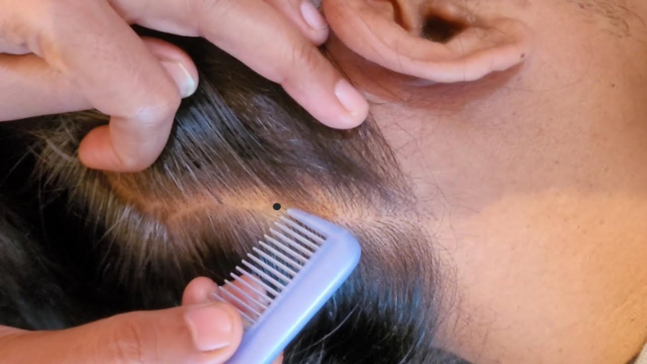 ASMR -Tingly Relaxing Scalp Picking & Scratching, Hair Pulling, Close - Up Inspection & Scalp Check 