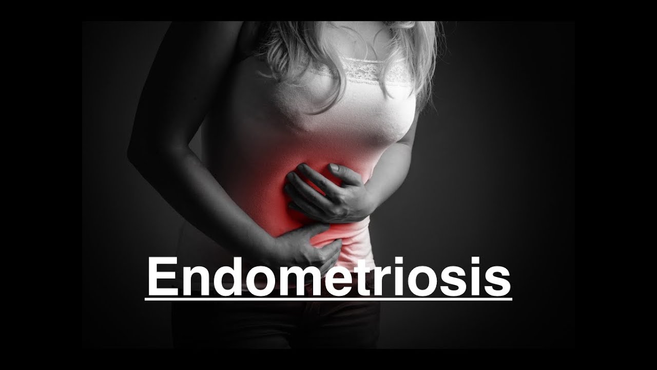 Endometriosis and PCOS Health Rant