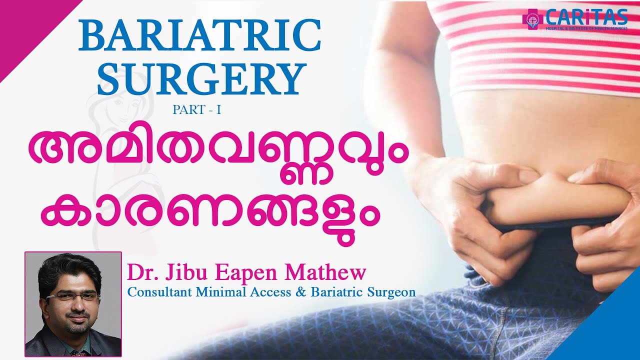 Bariatric Surgery - അമിത വണ്ണവും കാരണങ്ങളും,Caritas Hospital General Surgeon Dr.Jibu Eapen Mathew...