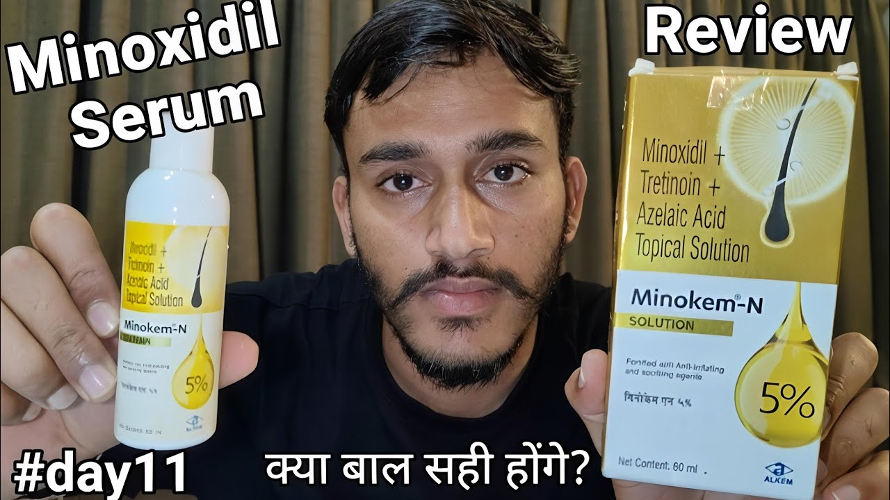 Minokem N 5% hair regrowth serum review 😱 use करने का सही तरीका! minoxidil serum solution 