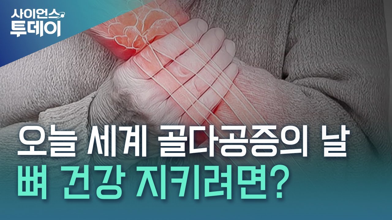 오늘 세계 골다공증의 날...뼈 건강 지키려면? / YTN 사이언스
