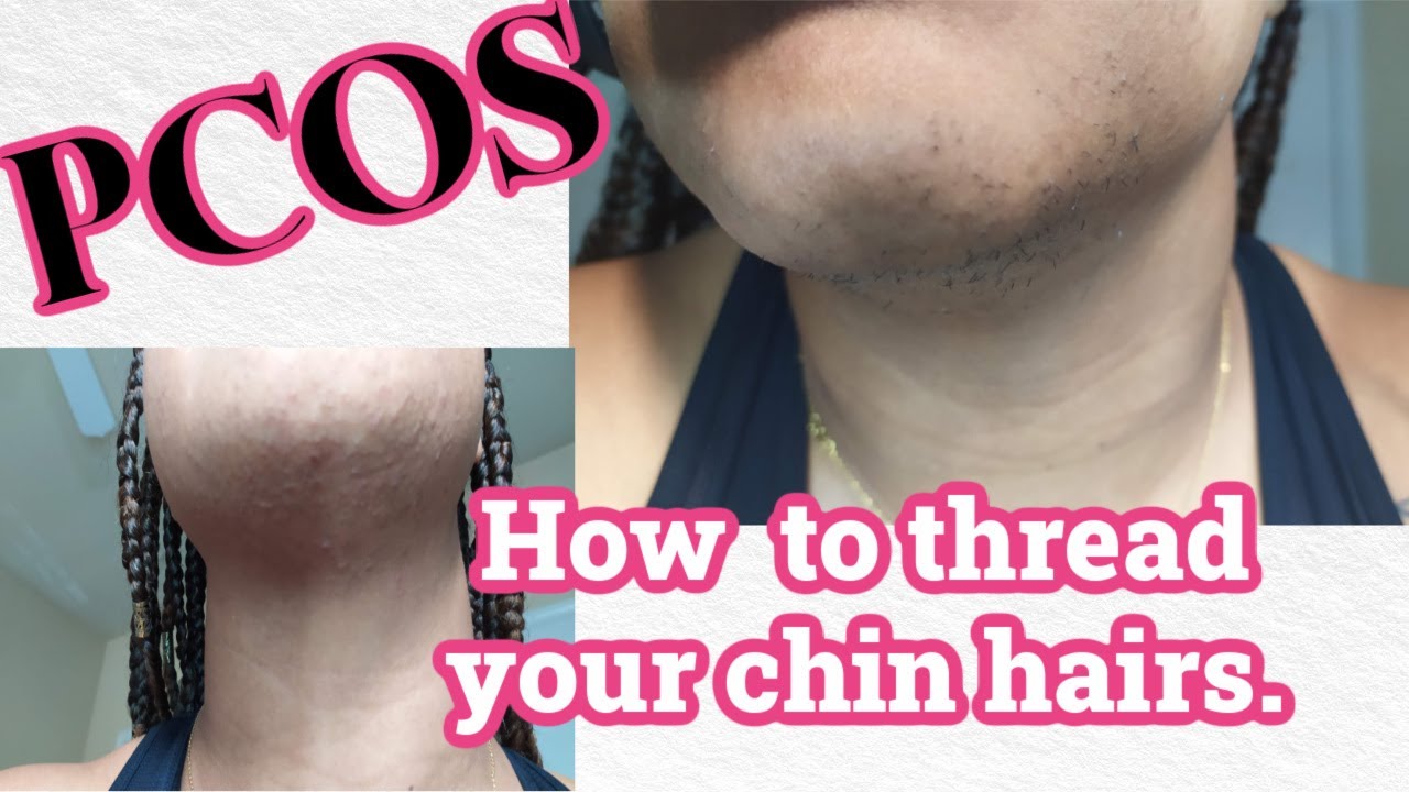 How to thread your Chin| PCOS | Hormonal Unbalance.