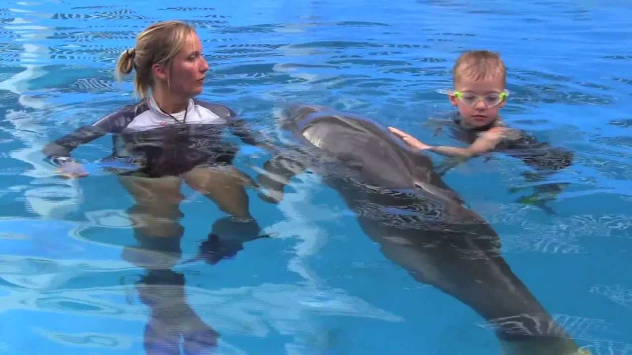 Cieran Kelso Uses Prosthetic Flippers to Swim with Dolphin