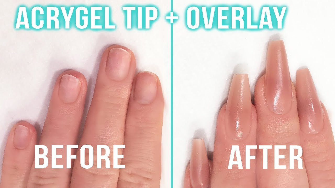 How To: Tip and Overlay with AcryGel