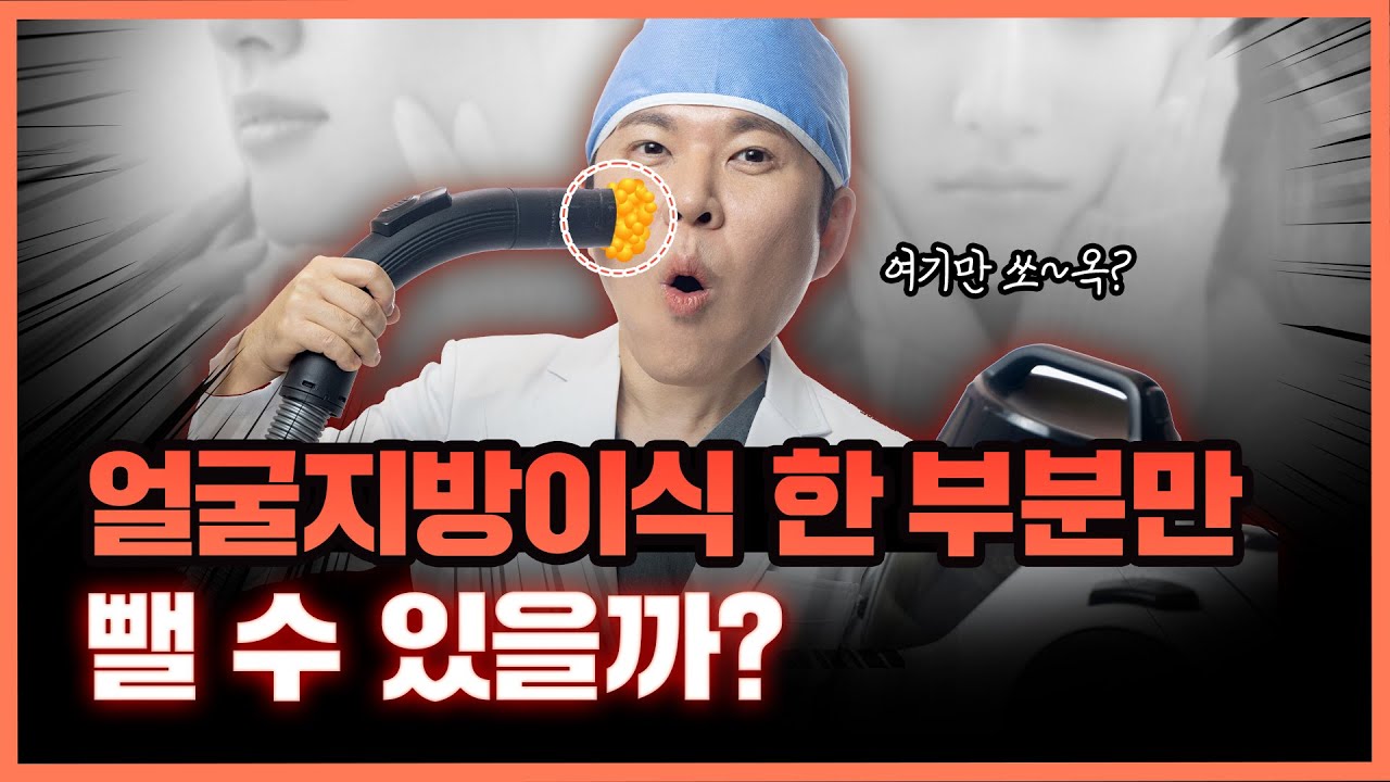 ❌얼굴지방이식 망했는데.. 이식한 부위만 뺄 수 있나요? 원래 얼굴로 돌아갈 수 있을까? 👉지방 과주입, 과생착 지방 제거