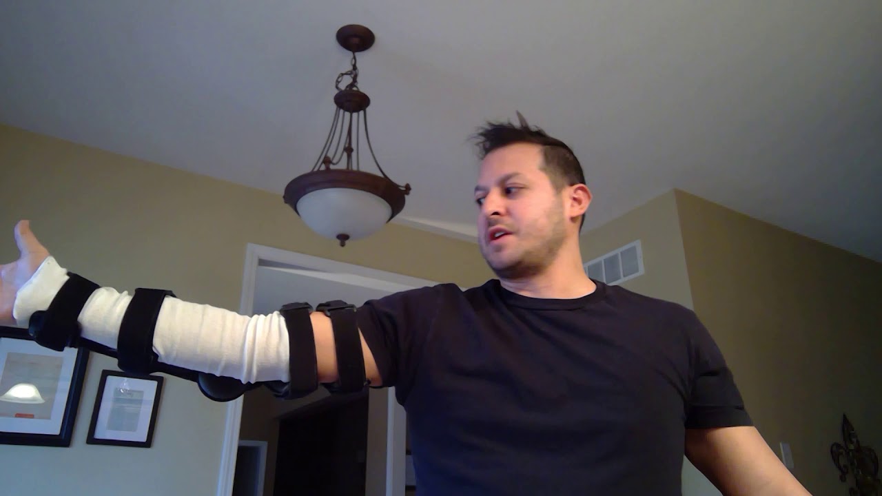 Distal Bicep Tendon Rupture Surgery Update