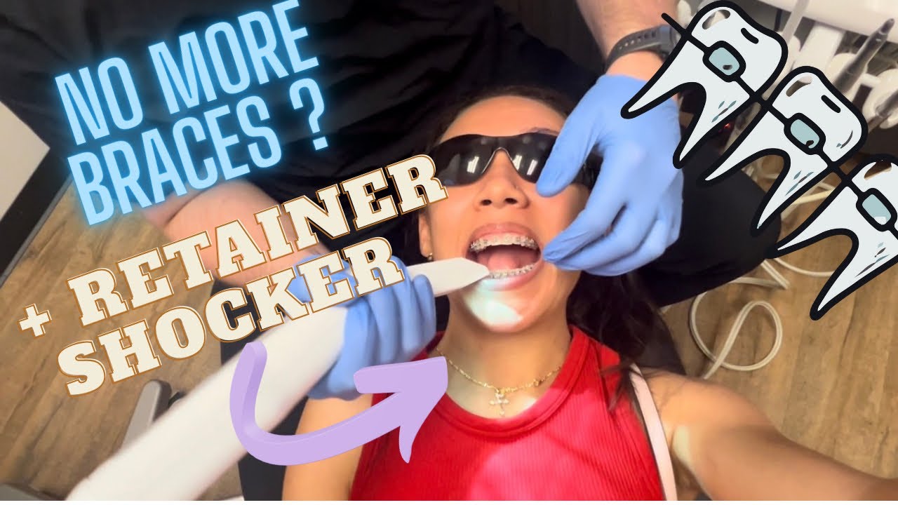 My Braces Removed + Retainer shocker 😱