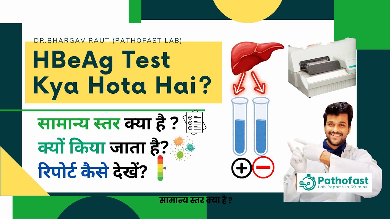 HbeAg Test | Hepatitis B  Envelope Antigen Kya hota hai | HbeAg in Hindi | HbeAg Report kaise dekhe