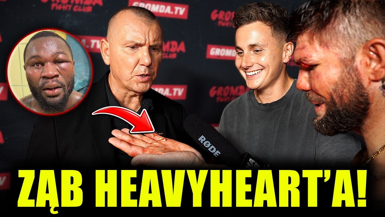 DON DIEGO PRZYNI&Oacute;SŁ ZĄB HEAVYHEART&rsquo;A XD GRABOWSKI I HUBERT W SZOKU!