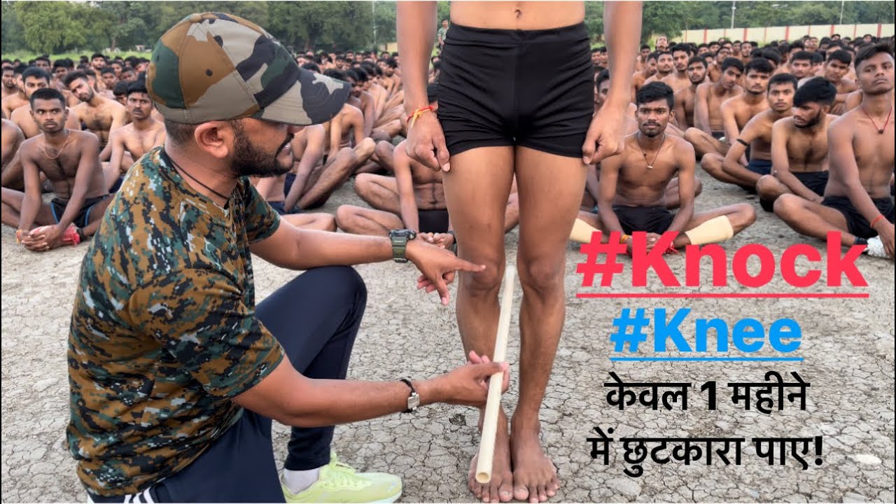 केवल 1 महीने में Knock Knee से छुटकारा पाए ये 5 Exercises प्रतिदिन करिए!