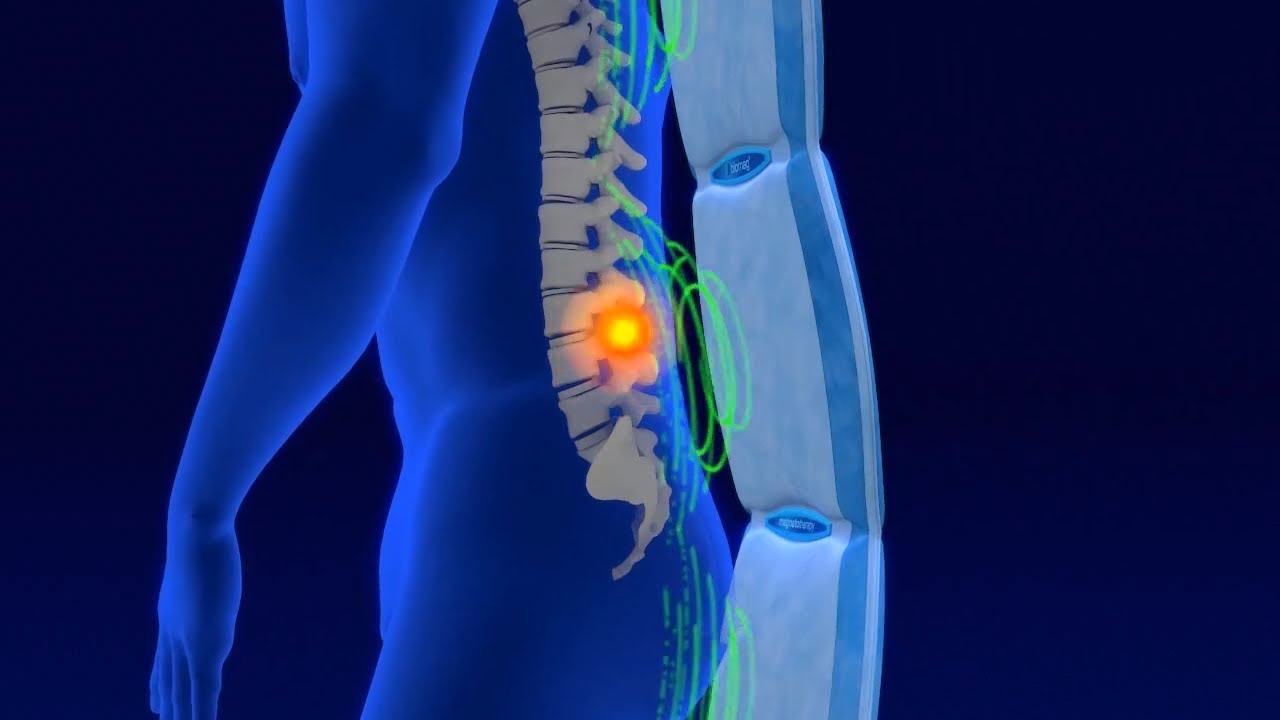 Pulsierende Magnetfeldtherapie Biomag - interessante Informationen für Interessenten