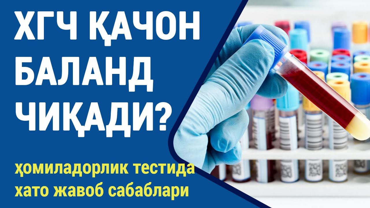 ХГЧ қачон баланд чиқади?