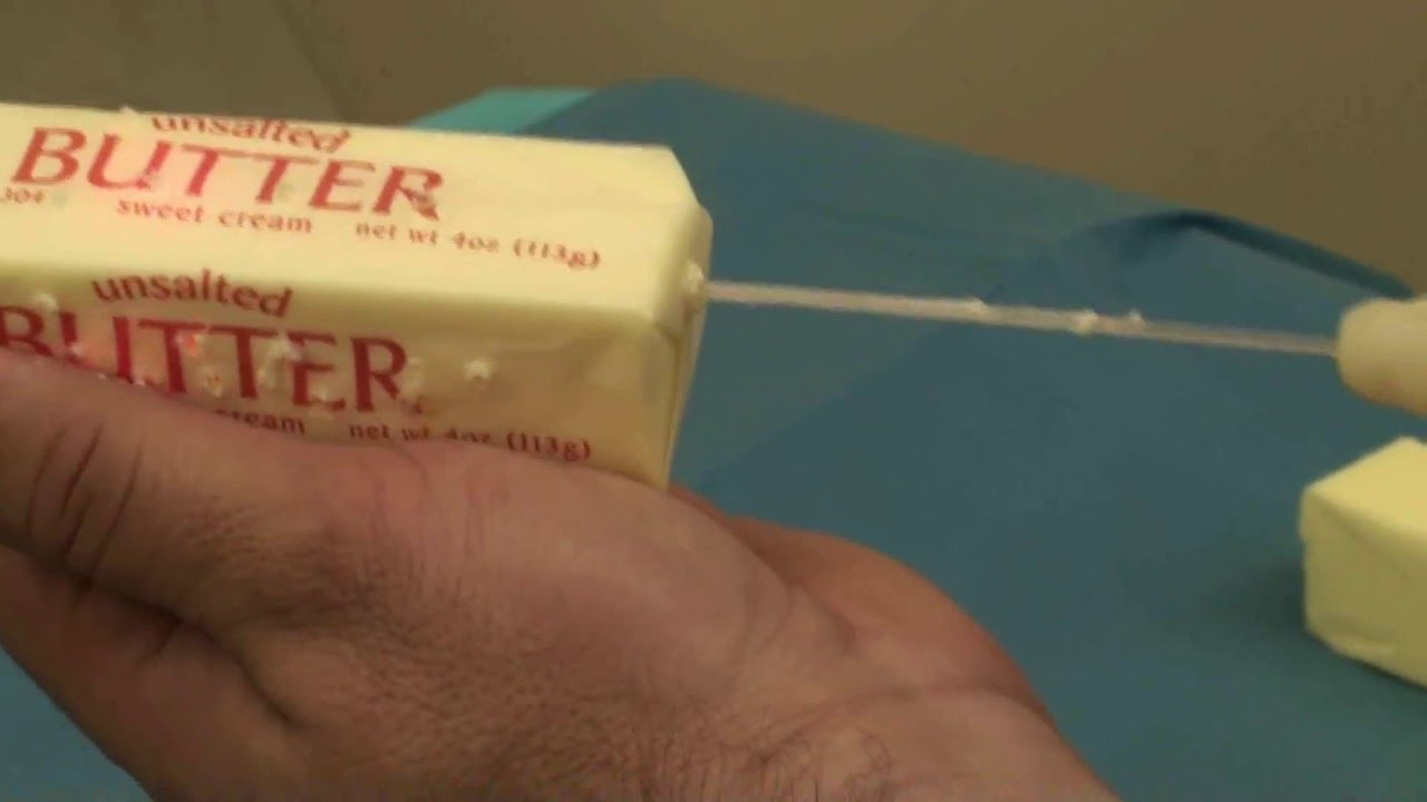 SlimLipo Laser Liposuction, Like Butter!